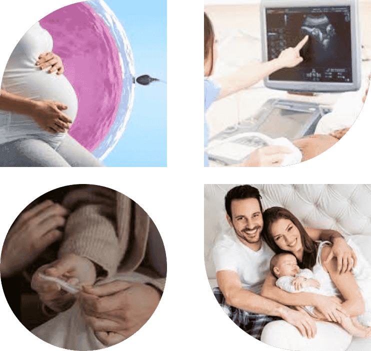 Fertility Treatments-image
